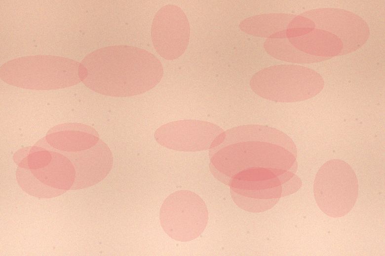 Textura ilustrativa de pele sensível com vermelhidão